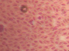 Imagen de microscopio. Extensión de sangre Glóbulos rojos de una paloma